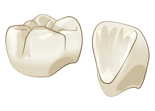 ジルコニアセラミッククラウン